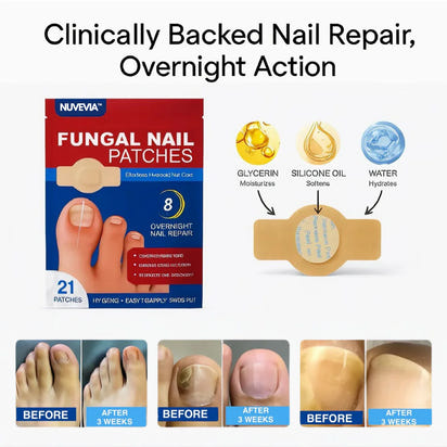 Nuvevia™ Fungal Nail Repair Patches