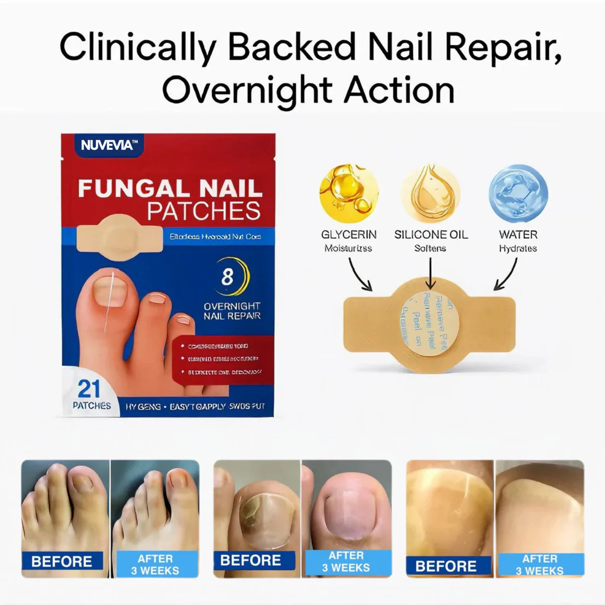 Nuvevia™ Fungal Nail Repair Patches