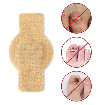 Nuvevia™ Fungal Nail Repair Patches