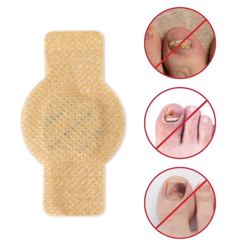 Nuvevia™ Fungal Nail Repair Patches
